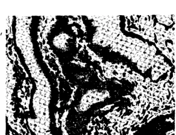 Fig. 5. Papillary eystadenoma of the gallbladder. Adenoma showing eharcetcristie tall eolumnar typc epithelium.