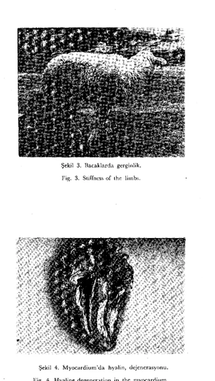 Şekil 3. Bacaklarda gerginlik. Fig. 3. Stiffncss üf the limbs.