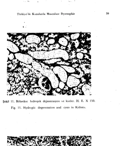 Şekil i i. Böbrekıe hidropik dejenerasyon ve kistler. H. E. X ı 50. Fig. i ı. Hydropic degeneration and cysts in Kidney.