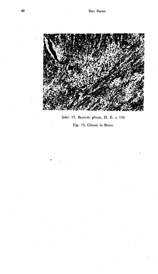 Şekil 13. Beyinde gliosis, H. E. x 150 Fig. 13. Gliosis in Brain.