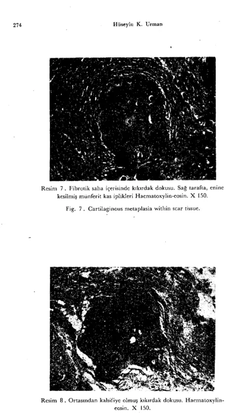 Fig. 8. Calcified cartilaginous tissuc.