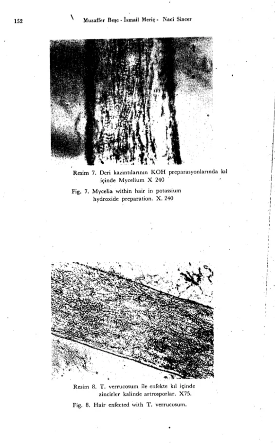 Fig. 7. Mycelia within Iiair in potassium hydroxide preparation. X. 240