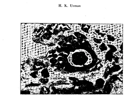 Fig. 3 - Intranudear and intraeytojllasmie incilision bodics in a hypertrophie epithe- epithe-!ium eel\.