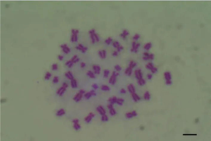 Figure  1.  Chromosome  image  from  a  normal,  healthy  individual, 24-hour treatment (x1000) 