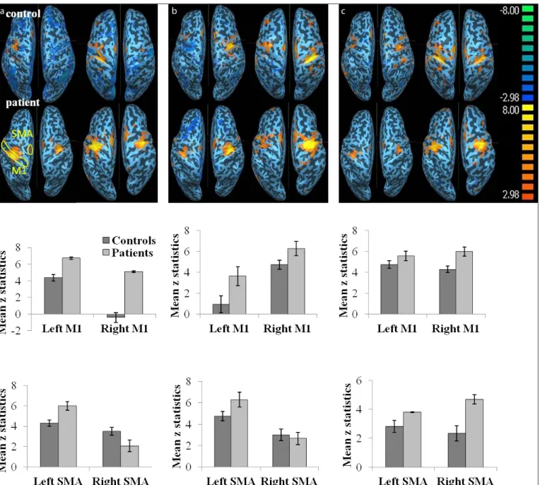 Figure 1. a–c. Comparison of fMRI responses in patients and controls in primary motor cortex hand area (M1) and supplementary motor area (SMA)