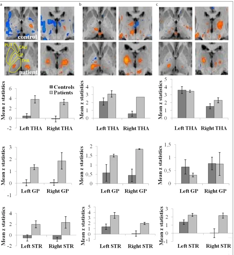 Figure 2. a–c. Comparison of fMRI responses in patients and controls in thalamus (THA), globus pallidus (GP), and striatum (STR, consisting of caudate nucleus [CAU] 