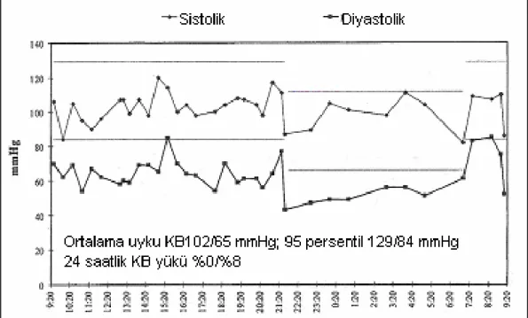 Şekil 2.3.’te 11 yaşında sağlıklı bir kız çocuğun normal AKBM seyri verilmiştir (6). Grafik 24  saatlik monitorizasyon periyodu için sistolik ve diyastolik KB’larını göstermektedir