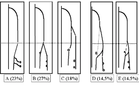 Şekil  2.9.  Vena  safena  magnanın  fasiyal  kompartmanlarla  ilişkisi  ve  diz  düzeyindeki  anatomik varyasyonlarının şematik görünümü