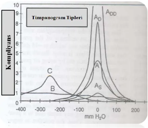 Şekil 1: Timpanogram Tipleri (37) 