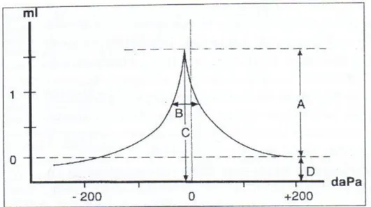 Şekil 2: Timpanogramın değerlendirilmesi (39)  (A) Statik admitans 