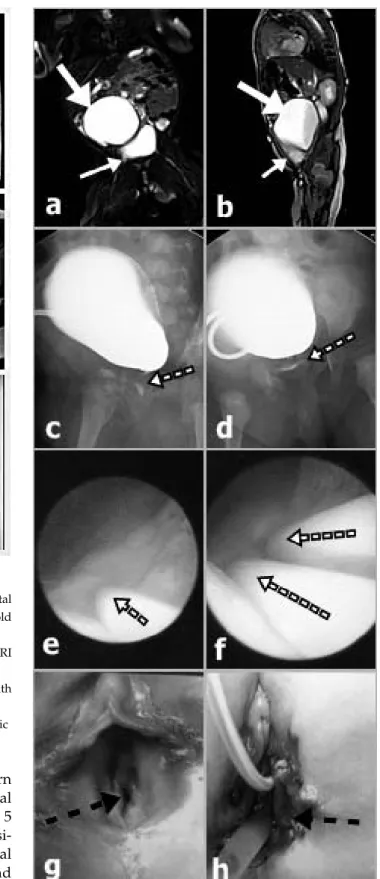 Fig. 3 A 16-year-old female patient presented with a
