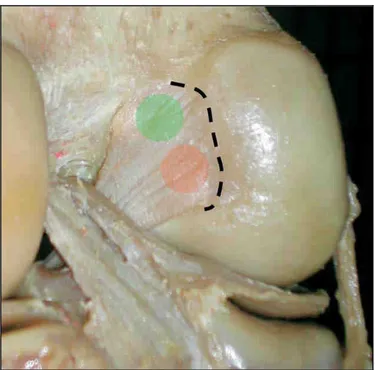 Şekil 2.2:  Ön  çapraz  bağın  posteriordan  yelpaze  şeklindeki  femoral  yapışma  yerinin 