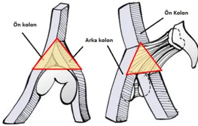 Şekil 2.9: Asetabulumun anterior ve posterior kolon ile ilişkisi: medial ve lateralden  görünüm 