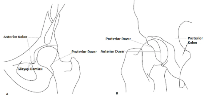 Şekil 2.11: Obtrator ve iliak oblik grafiler ve radyolojik belirteçler  A: Obtrator oblik direk grafide anterior kolon ve posterior duvarın görünümü B: İliak oblik direk grafide posterior kolon ve anterior duvarın görünümü