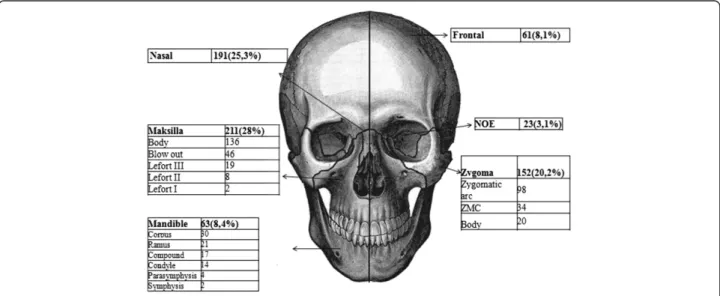 Figure 1 Facial fractures according to anatomical sites.