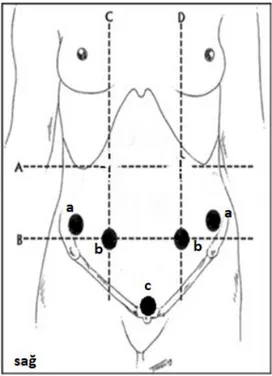 ġekil 3.2. Algometre ile abdominal bölgede ölçüm yapılan noktalar; a: Spina iliaka 