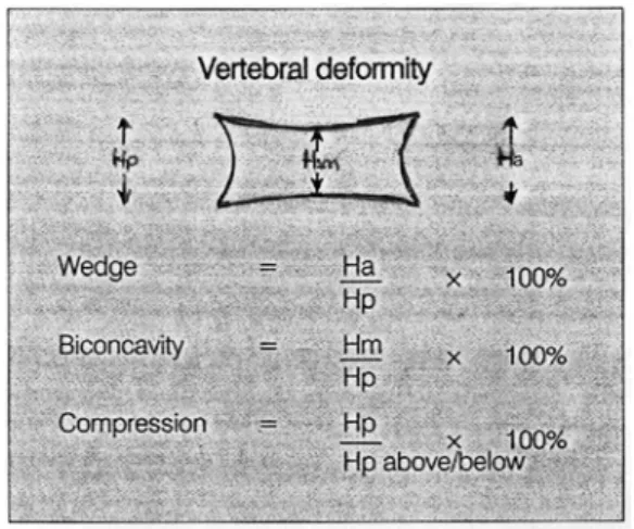 Şekil 2.1 : Vertebral deformite ölçümü (21) 