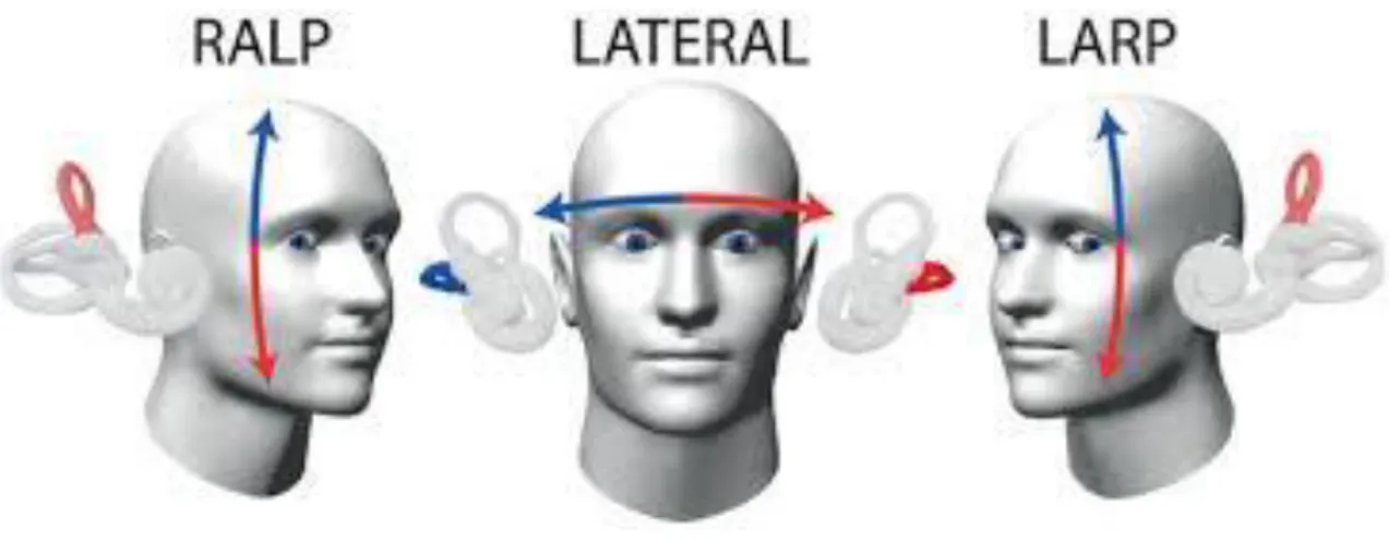Şekil 11 Video Head İmpulse Testin Yapılışı  (51) 