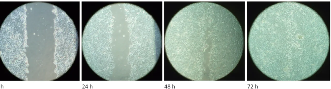 Table 2. Effects of b-AR antagonists and isoprotrenol on invasion of MCF7, HT-29 and HepG2 cells incubated for 24 h