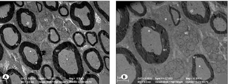 Figure 5: A) m1: Large diameter myelinated nerve fiber, m1: Small diameter myelinated nerve fiber, m2: unmyelinated nerve fibers, *: 