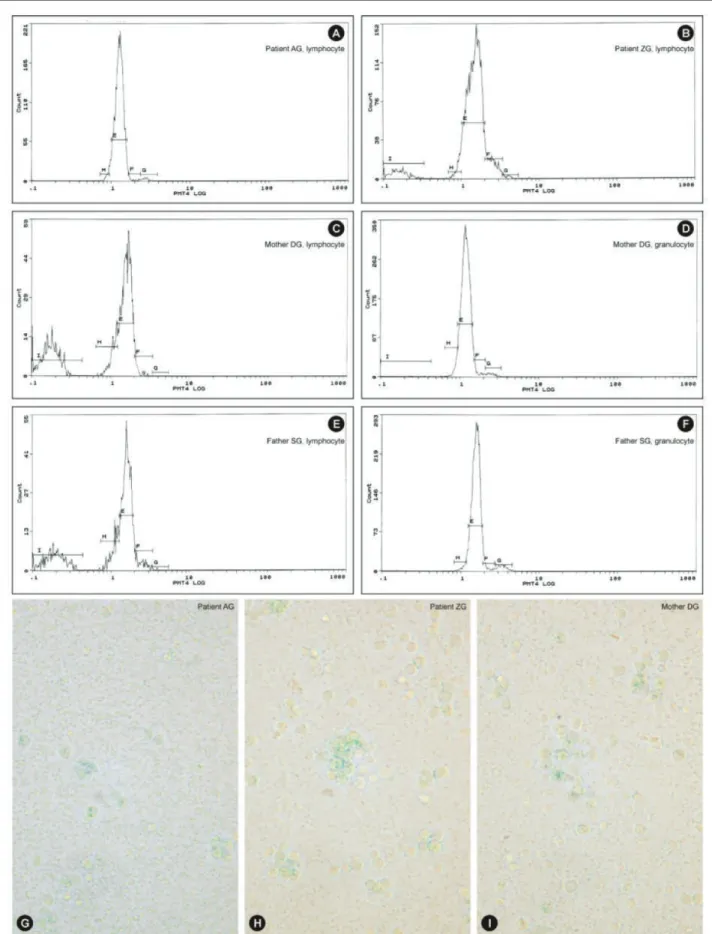 Figure 3. Cell cycle patterns of two sibling patients, their mother, and their father: A) normal cell cycle (patient AG, lymphocyte; sibling 