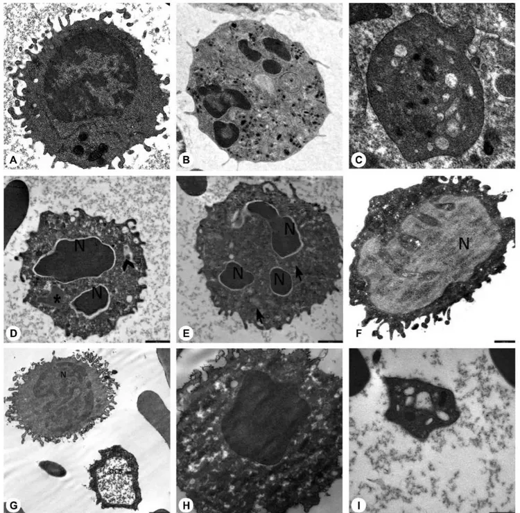 Figure 5. Electron microscopic images of the blood cells of the parents. A) Normal lymphocyte (16700 x ), B) normal neutrophil (3597 x ), C) 