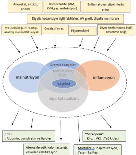 Şekil 2.1: KBH’de Protein-Enerji Kaybı Sendromu ve Eksenindekiler 