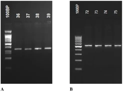 Şekil 6. STAT3 geninde PZR-RFLP yöntemi ile analiz edilen rs744166 ve rs4796793 polimorfizmleri 
