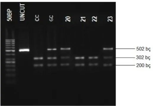 Şekil 7.  rs4796793 (502 bç) MwoI restriksiyon endonükleaz enzimi ile kesim paternlerinin görüntüsü.