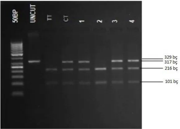 Şekil  8.  rs744166 (329 bç) AluI restriksiyon endonükleaz  enzimi ile  kesim paternlerinin görüntüsü.