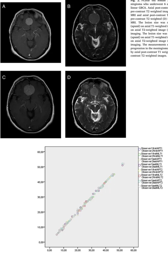 Fig. 3. Scatter plot diagram shows the dimensions of meningiomas measured by observer 1 versus observer 2 from the ﬁrst and last brain MRIs on axial postcontrast T1 weighted images and axial precontrast T2 weighted images