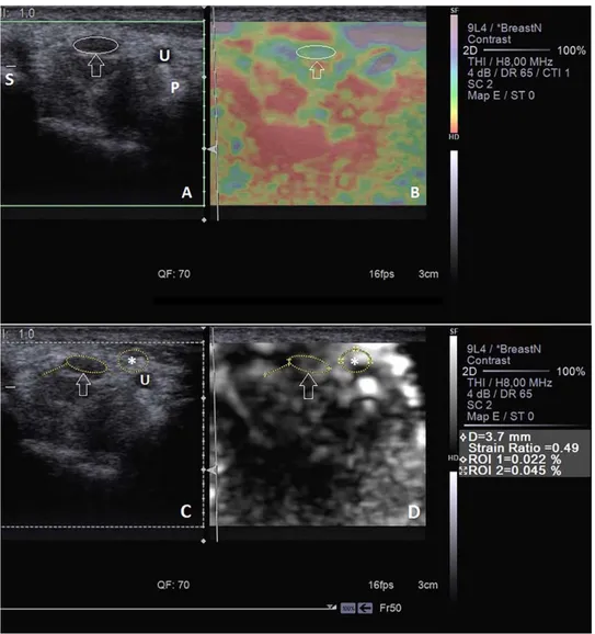 Figure 2. Images from a 55-year old woman with mild CTS after low-level laser therapy (3 weeks after Figure 1 was obtained)