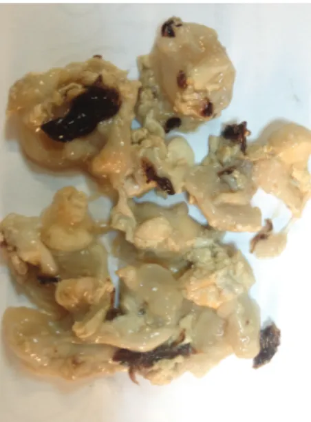 Figure 2. The image of hydatid cyst material
