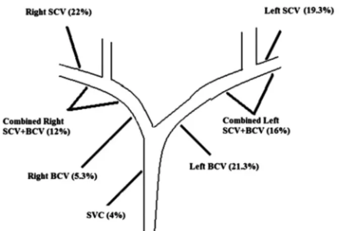 Figure 1. Diagram shows all central vein lesion sites in 150 patients with corresponding prevalence in percentage