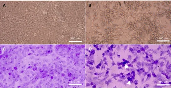 Figure 1. Cytopathology of SARS-Cov-2 Ank-1 isolate in Vero E6 cells. Upper row: (unstained): mock-infected cells (A), virus-infected cells (B); Lower row (crystal violet): mock-infected cells (C), D: virus-infected cells (D)