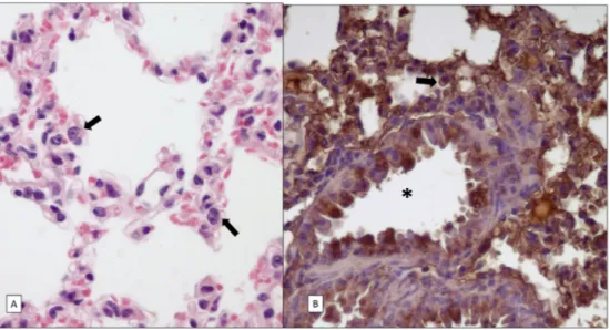 Figure 5. Hematoxlyin-eosin (A) and IHC (B) staining of respiratory epithelium in the IFNAR / mouse with prominent lung ﬁndings