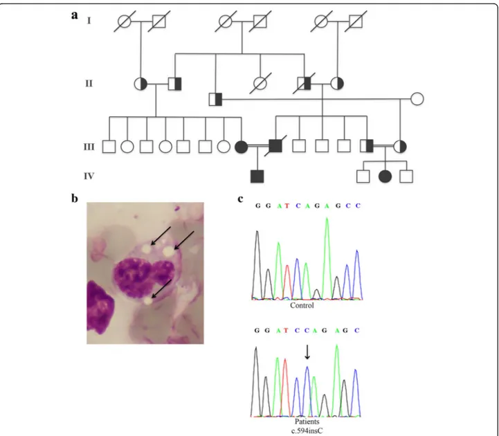 Fig. 1 Pedigree of CDS family (a). Microphotographs of May-Grünwald-Giemsa buffy coats of patient III-1 showing Jordan ’s anomaly (arrows); original magnification 1000× (b)