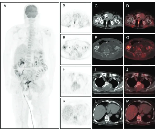 Figure 1. The case patient was a 69-year-old man who presented with the complaint of back pain