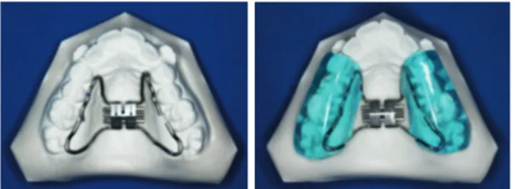 Figure 2a.  Angular measurements used in the evaluation of the  lateral  cephalometric  radiographs  1