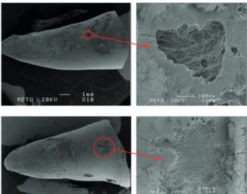 Figure 10.  Scanning electron microscope images of the group  rapid maxillary expansion