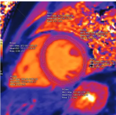 FIG. 1.  The  endocardium  and  epicardium  were  manually  outlined. 