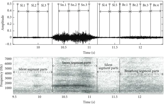 Figure 2: Subdivision procedure of SRSs segments: snore, breathing, and silent segment parts.