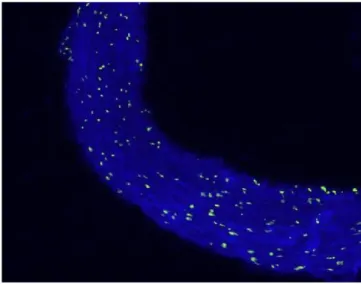 Fig. 2B - Terminal deoxynucleotidyl transferase-mediated dUTP- dUTP-biotin nick end labeling (TUNEL) stain of an artery in the diltiazem  group (Group D).