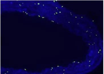Fig. 2C – Terminal deoxynucleotidyl transferase-mediated  dUTP-biotin nick end labeling (TUNEL) stain of an artery in the  nitroprusside group (Group N).