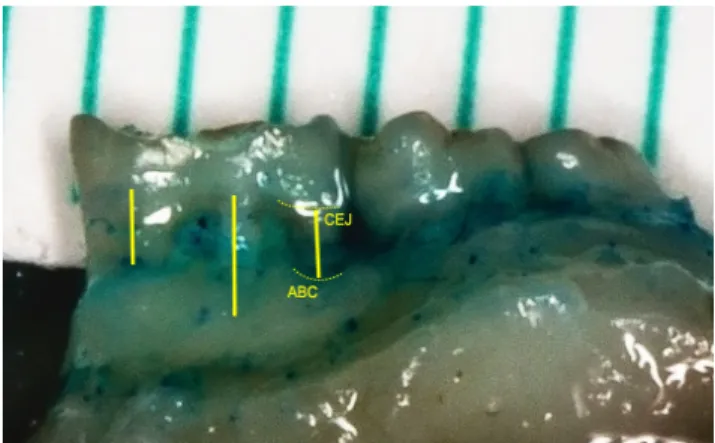 Figure  1.   Image  of  alveolar  bone  loss  evaluation  through  indirect  linear  morphometric  measurement
