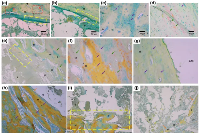 FIGURE 6 Detailed images of Movat's pentachrome staining results at the end of eighth week postimplantation for PC ‐0 (A‐D), PC‐10 (E‐G), and PC ‐20 (H‐J)