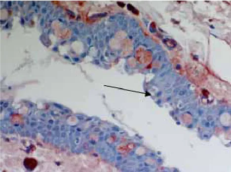 Şekil 26.  Suramin grubunda konjonktival epitelde VEGF ekpresyonu yoktur.  Eksprese olmamış konjonktival epitel hücresi izlenmektedir (x 40) 