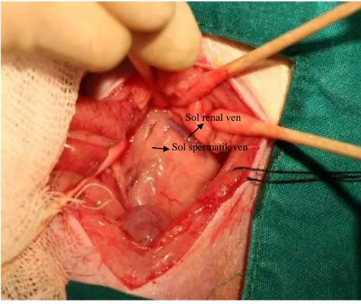 ġekil 3.1: Barsakların sağ tarafa deviye edilmesinden sonra sol renal venin ve sol spermatik venin açığa                    çıkarılması