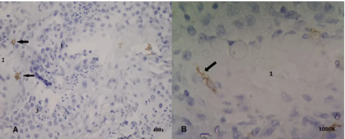 Figure 1. Distribution of Cajal-like cells in testis of the obstructive azoospermia group