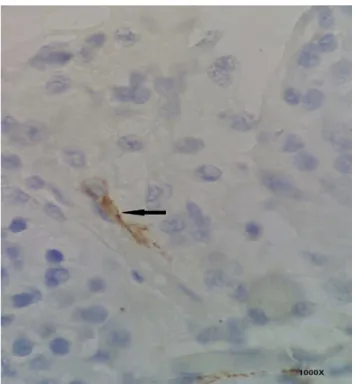Figure 3. Peritubular Cajal-like cell. The black arrow in- in-dicates peritubular Cajal-like cell (hematoxylin staining, magnification, 1000x)